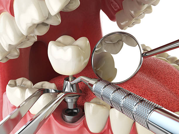 Best Orthodontic Emergency Dentist in Stem, NC